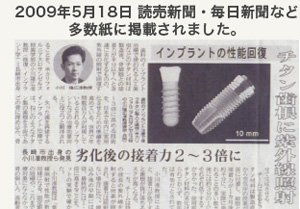 スーパーオッセオインテグレーションの新聞記事