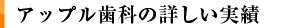 アップル歯科クリニックのインプラント治療