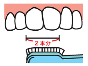 オススメの歯ブラシ