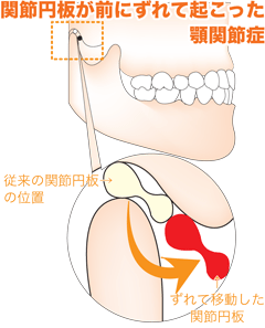 このような場所が痛くなります。