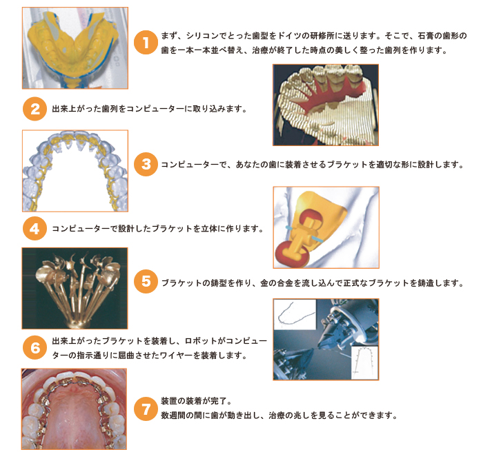 アイブレイスシステム