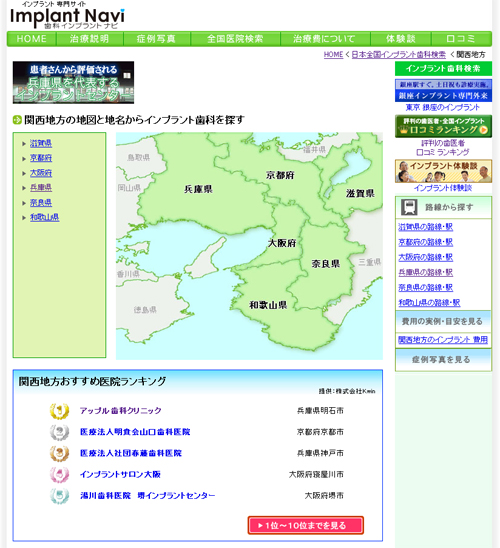 インプラントナビ 関西おすすめ医院ランキング