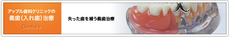 義歯治療とは