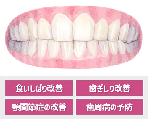 食いしばりや歯ぎしりによって起こるリスク