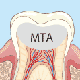 MTAセメント