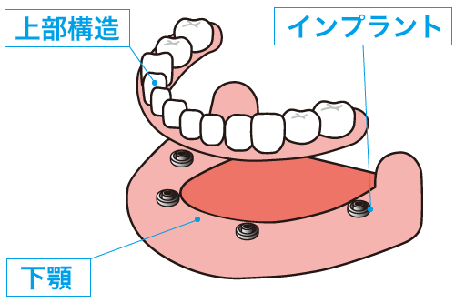 オールオン4のイラスト