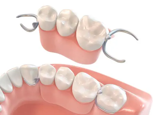 入れ歯イメージ