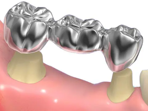 ブリッジイメージ