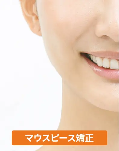 マウスピース矯正装着時