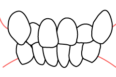 叢生の線画