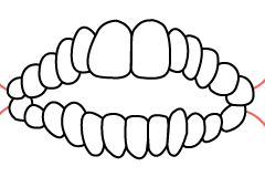 開咬の線画