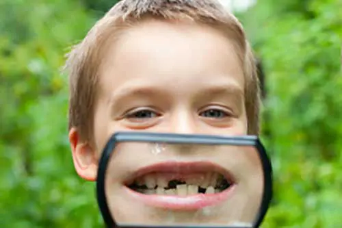 歯が抜けた子供