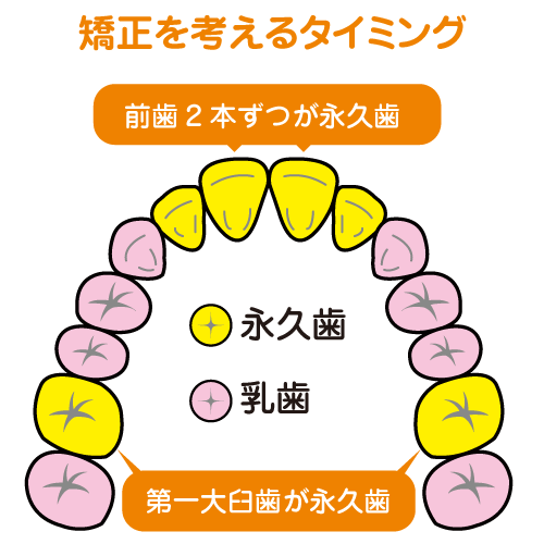矯正を始めるタイミング