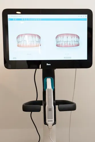 矯正シミュレーション