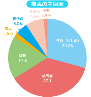 抜歯の主な原因のグラフ