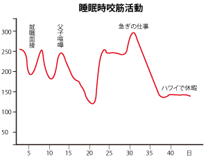 睡眠時咬筋活動のグラフ