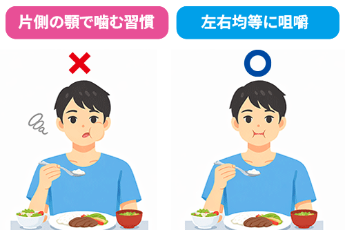 片顎咀嚼と両顎咀嚼の対比イラスト