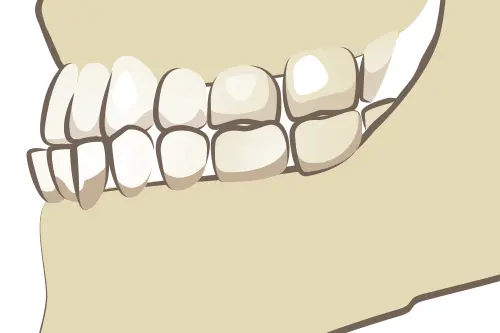 骨格のイメージ