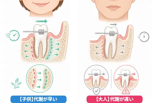 骨代謝によって歯が少しずつ動くメカニズムのイメージ