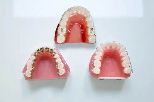 矯正装置を持った女性