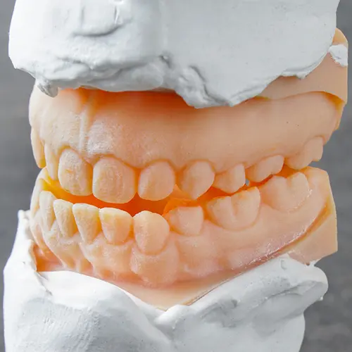 しゃくれ矯正についてのアイキャッチ画像