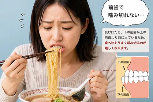 しゃくれが見た目だけでなく機能面にも影響するイメージ