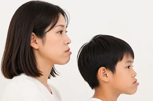 遺伝による骨格的な受け口の要因イメージ