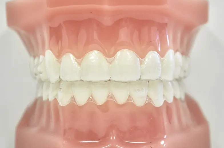 透明なマウスピース矯正装置のイメージ