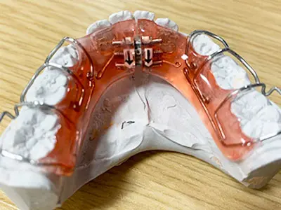 小児用拡大床の模型