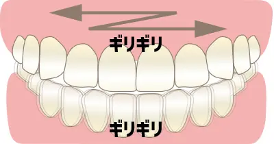 上下の歯をギリギリとこすり合わせる