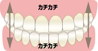 カチカチと歯を上下に噛み合わせる