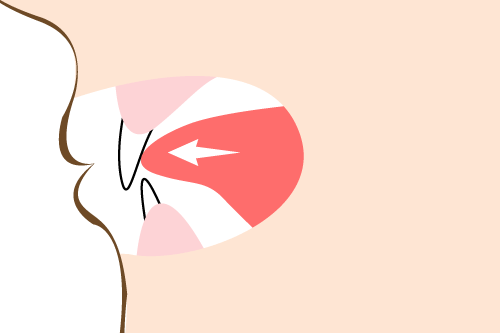 舌で前歯を押す癖（舌突出癖）のイメージ図