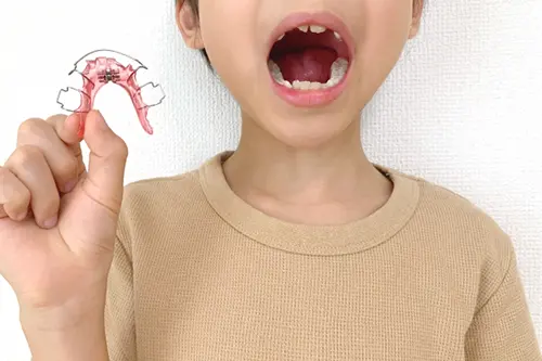 混合歯列期で矯正開始