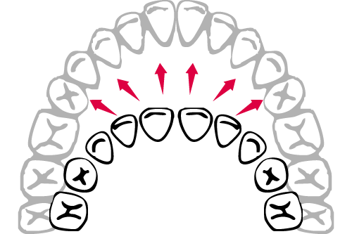 顎の成長イメージ