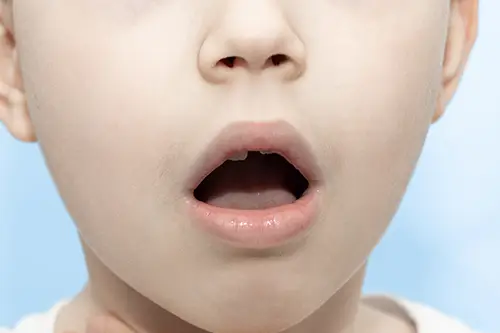 ぽかんと口を開けた子供