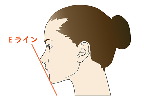 Eラインと矯正のイメージ
