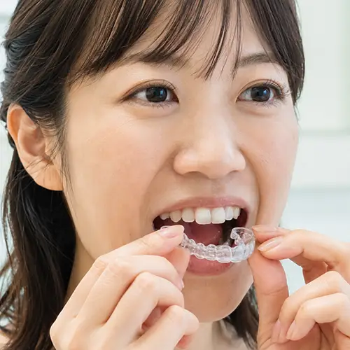 マウスピース矯正で出っ歯を治す治療イメージ