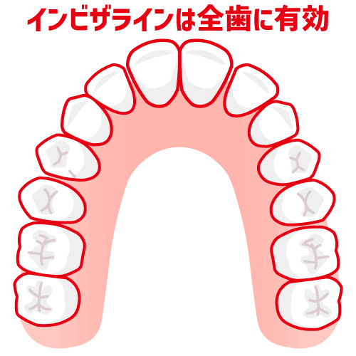 iGoのシミュレーション