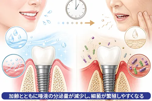 インプラントの寿命と老後の口腔環境変化を示すイメージ図