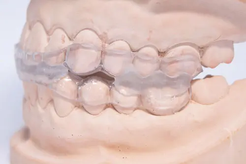 スプリント療法のマウスピース型装置のイメージ