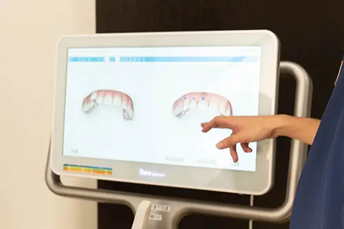 マウスピース矯正によるオーダーメイドの治療計画のイメージ