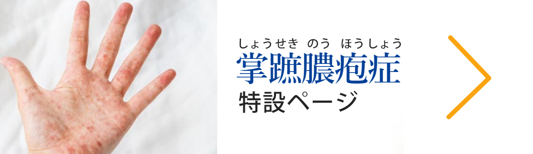 掌蹠膿疱症治療特設ページ