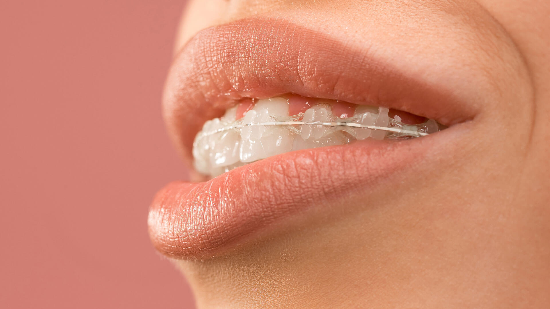 口ゴボ くちごぼ の治し方 明石市の歯医者 明石アップル歯科