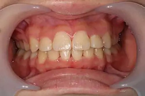 治療後正面観