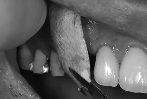 process1